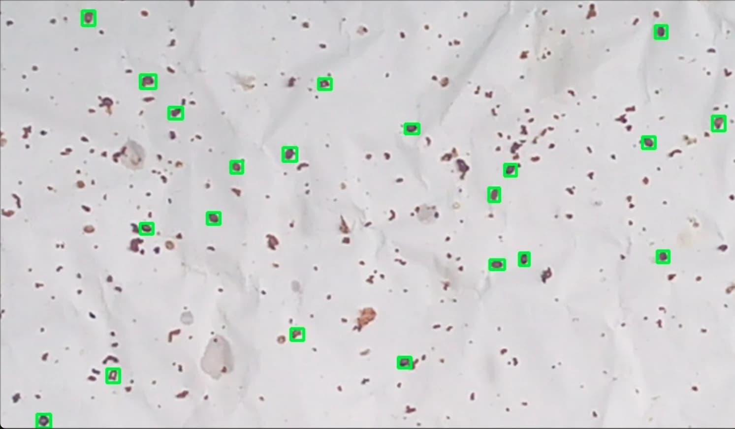 Varroa w pasiece — leczenie, terminy i okresy karencji
